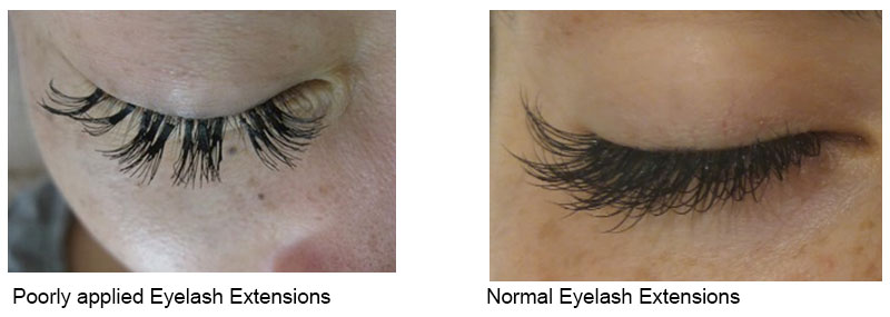 Repair Eyelash Extensions